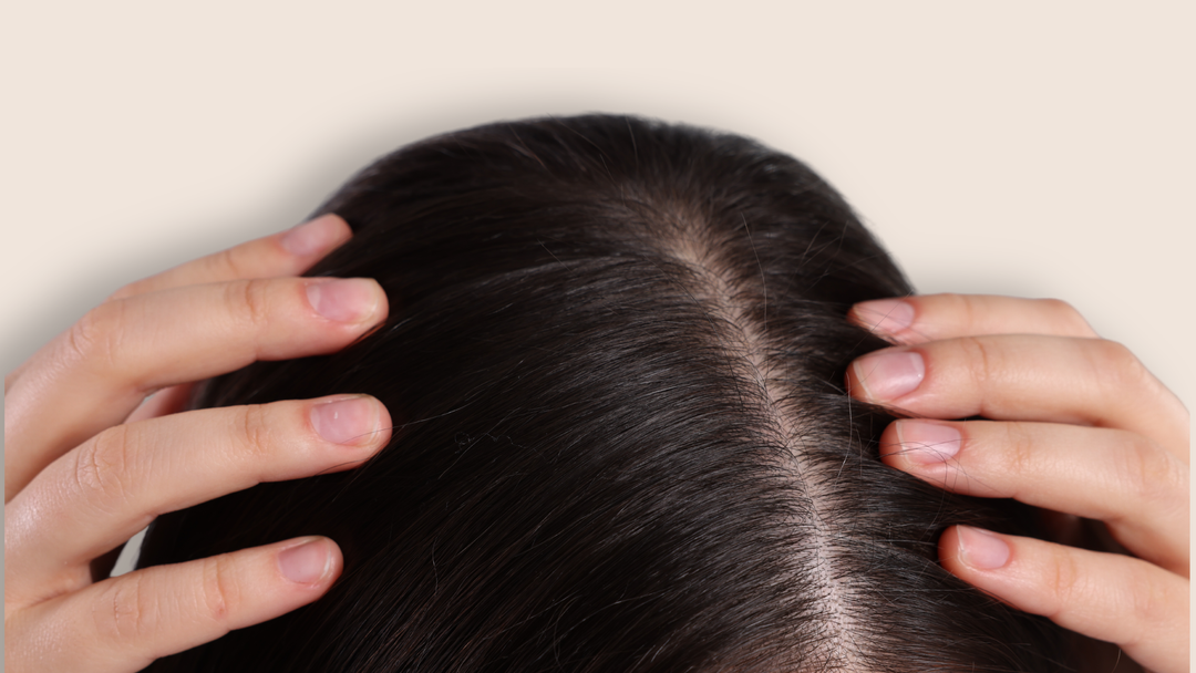 CUIR CHEVELU SAIN VS IRRITÉ : COMMENT RECONNAITRE LES SIGNES ET RETROUVER L'ÉQUILIBRE CAPILLAIRE  ?