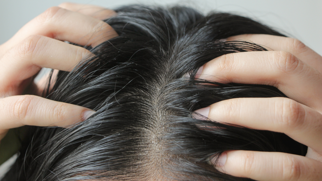 CURE DE SEBUM : BONNE OU MAUVAISE IDÉE ?